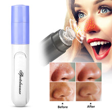 Load image into Gallery viewer, Acne Blackhead Remover Electric Face Massage Cleaner Blackhead Vacuum Apparatus Deep Face Clean Pore Vacuum Black Head Removal